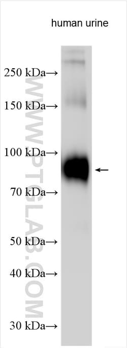 Uromodulin Rabbit Polyclonal Antibody, Proteintech:Antibodies:Primary Antibodies