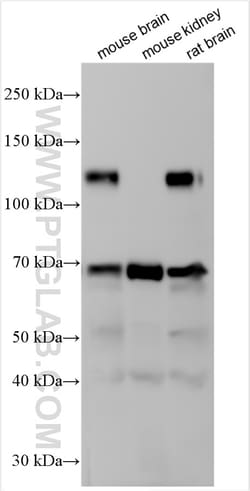 UNC5D Rabbit Polyclonal Antibody, Proteintech Unconjugated; 150 &mu;L:Antibodies,