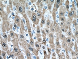 UNG Mouse Monoclonal Antibody, Proteintech Unconjugated; 150 &mu;L:Antibodies,
