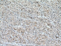 UNG Mouse Monoclonal Antibody, Proteintech Unconjugated; 150 &mu;L:Antibodies,