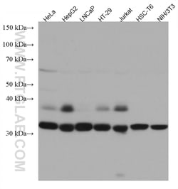 UNG Mouse Monoclonal Antibody, Proteintech Unconjugated; 150 &mu;L:Antibodies,