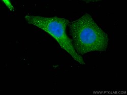 USP11 Mouse Monoclonal Antibody, Proteintech Unconjugated; 150 &mu;L:Antibodies,