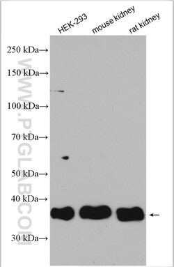 USP12 Rabbit Polyclonal Antibody, Proteintech 20 &mu;L | Buy Online | Proteintech | Fisher Scientific