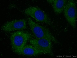 USP14 Mouse Monoclonal Antibody, Proteintech Unconjugated; 20 &mu;L:Antibodies,