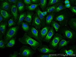 USP36 Mouse Monoclonal Antibody, Proteintech:Antibodies:Primary Antibodies
