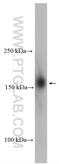 UTX Rabbit Polyclonal Antibody, Proteintech 20 &mu;L | Buy Online | Proteintech | Fisher Scientific