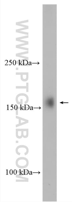 UTX Rabbit Polyclonal Antibody, Proteintech 20 &mu;L | Buy Online | Proteintech | Fisher Scientific