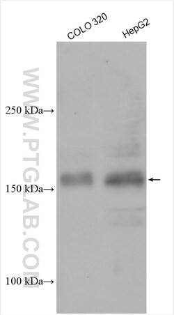 UTX Rabbit Polyclonal Antibody, Proteintech 20 &mu;L | Buy Online | Proteintech | Fisher Scientific