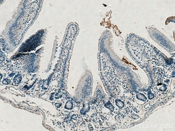 Villin like Rabbit Polyclonal Antibody, Proteintech Unconjugated; 150 &mu;L:Anticorps,