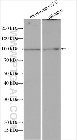 Villin like Rabbit Polyclonal Antibody, Proteintech Unconjugated; 150 &mu;L:Anticorps,