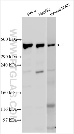 VPS13C Rabbit Polyclonal Antibody, Proteintech Unconjugated; 20 &mu;L:Antibodies,