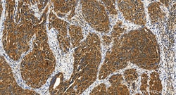 VPS13D Rabbit Polyclonal Antibody, Proteintech Unconjugated; 20 &mu;L:Antibodies
