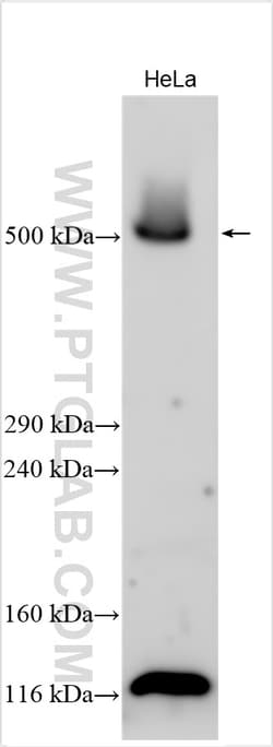 VPS13D Rabbit Polyclonal Antibody, Proteintech Unconjugated; 20 &mu;L:Antibodies
