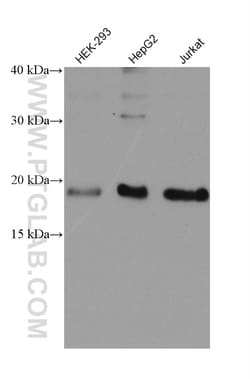 VPS25 Mouse Monoclonal Antibody, Proteintech Unconjugated; 150 &mu;L:Antibodies,