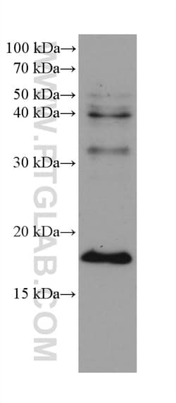 VPS25 Mouse Monoclonal Antibody, Proteintech Unconjugated; 150 &mu;L:Antibodies,