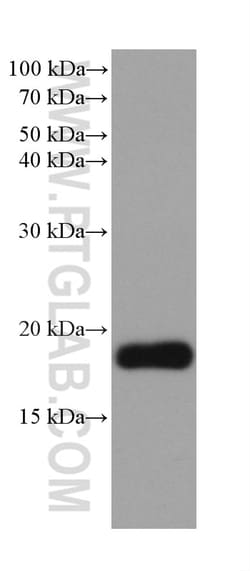 VPS25 Mouse Monoclonal Antibody, Proteintech Unconjugated; 150 &mu;L:Antibodies,