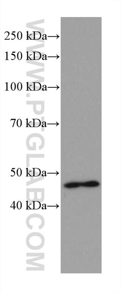 VSX2 Mouse Monoclonal Antibody, Proteintech Unconjugated; 150 &mu;L:Antibodies,