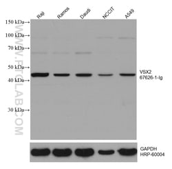 VSX2 Mouse Monoclonal Antibody, Proteintech Unconjugated; 150 &mu;L:Antibodies,