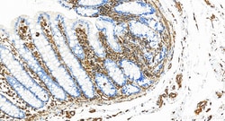 Vimentin Rabbit Recombinant Antibody, Proteintech:Antibodies:Primary Antibodies