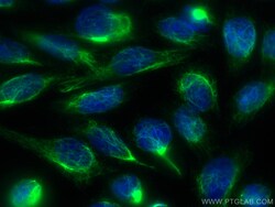 Vimentin Rabbit Recombinant Antibody, Proteintech:Antibodies:Primary Antibodies