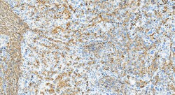 Vimentin Rabbit Recombinant Antibody, Proteintech:Antibodies:Primary Antibodies