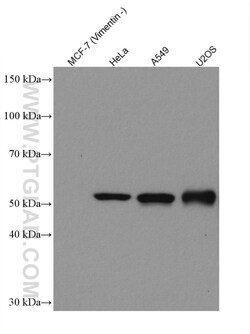Vimentin Rabbit Recombinant Antibody, Proteintech:Antibodies:Primary Antibodies