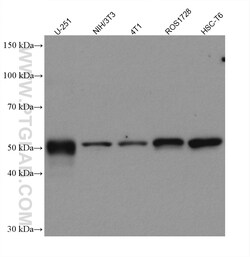 Vimentin Rabbit Recombinant Antibody, Proteintech:Antibodies:Primary Antibodies