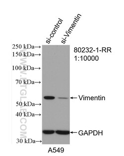 Vimentin Rabbit Recombinant Antibody, Proteintech:Antibodies:Primary Antibodies