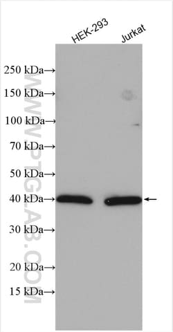 WDR77 Rabbit Polyclonal Antibody, Proteintech Unconjugated; 150 &mu;L:Antibodies,