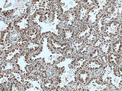 WNK2 Rabbit Polyclonal Antibody, Proteintech:Antibodies:Primary Antibodies