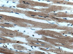 WNK2 Rabbit Polyclonal Antibody, Proteintech:Antibodies:Primary Antibodies