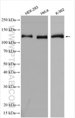 XPO5 Rabbit Polyclonal Antibody, Proteintech:Antibodies:Primary Antibodies