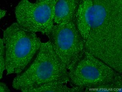 YWHAZ Mouse Monoclonal Antibody, Proteintech Unconjugated; 150 &mu;L:Antibodies,