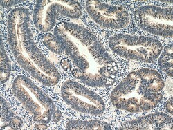 ZAK Rabbit Polyclonal Antibody, Proteintech Unconjugated; 20 &mu;L:Antibodies,