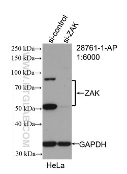 ZAK Rabbit Polyclonal Antibody, Proteintech Unconjugated; 20 &mu;L:Antibodies,