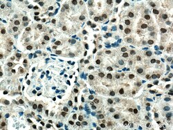 ZBTB8OS Rabbit Polyclonal Antibody, Proteintech Unconjugated; 20 &mu;L:Antibodies,