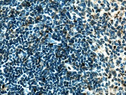 ZBTB8OS Rabbit Polyclonal Antibody, Proteintech Unconjugated; 20 &mu;L:Antibodies,