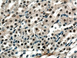 ZBTB8OS Rabbit Polyclonal Antibody, Proteintech Unconjugated; 20 &mu;L:Antibodies,