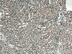 ZBTB8OS Rabbit Polyclonal Antibody, Proteintech Unconjugated; 20 &mu;L:Antibodies,