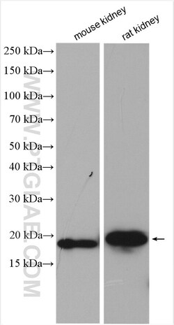 ZBTB8OS Rabbit Polyclonal Antibody, Proteintech Unconjugated; 20 &mu;L:Antibodies,
