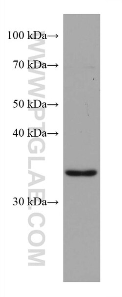 ZFP36L1 Mouse Monoclonal Antibody, Proteintech:Antibodies:Primary Antibodies