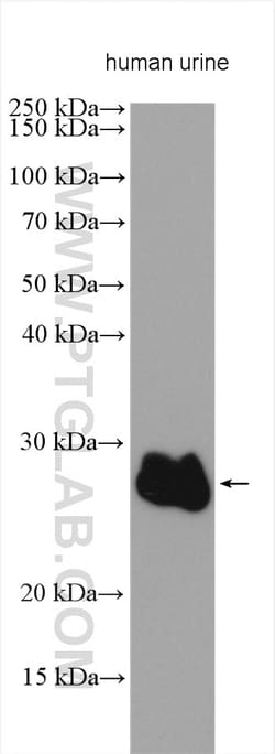ZG16B Rabbit Polyclonal Antibody, Proteintech Unconjugated; 150 &mu;L:Antibodies,