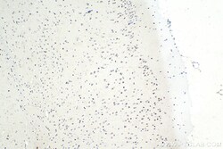 ZHX2 Mouse Monoclonal Antibody, Proteintech Unconjugated; 150 &mu;L:Antibodies,