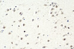 ZHX2 Mouse Monoclonal Antibody, Proteintech Unconjugated; 150 &mu;L:Antibodies,