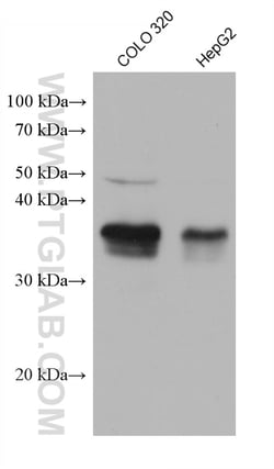 ZMAT3 Mouse Monoclonal Antibody, Proteintech Unconjugated; 150 &mu;L:Antibodies,