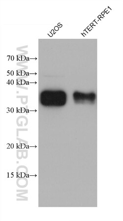 ZMAT3 Mouse Monoclonal Antibody, Proteintech Unconjugated; 150 &mu;L:Antibodies,