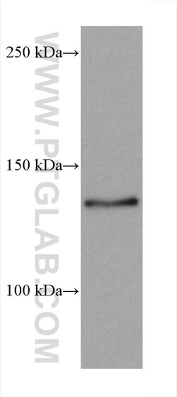 ZNF217 Mouse Monoclonal Antibody, Proteintech Unconjugated; 150 &mu;L:Antibodies,
