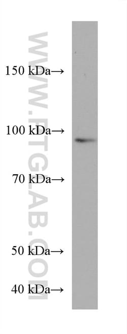 ZNF746 Mouse Monoclonal Antibody, Proteintech Unconjugated; 20 &mu;L:Antibodies,
