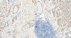 ZO-1 Rabbit Polyclonal Antibody, Proteintech:Antibodies:Primary Antibodies