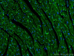 ZO-1 Rabbit Polyclonal Antibody, Proteintech:Antibodies:Primary Antibodies